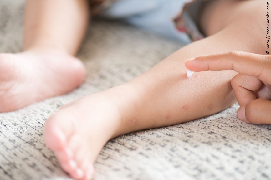 Das nackte Bein eines Babys wird eingecremt. 